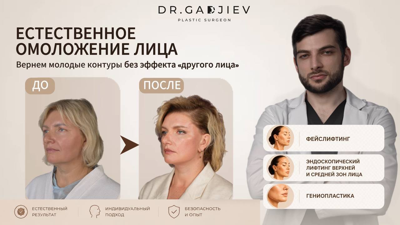 ПЛАСТИКА ЛИЦА от ГАДЖИЕВА