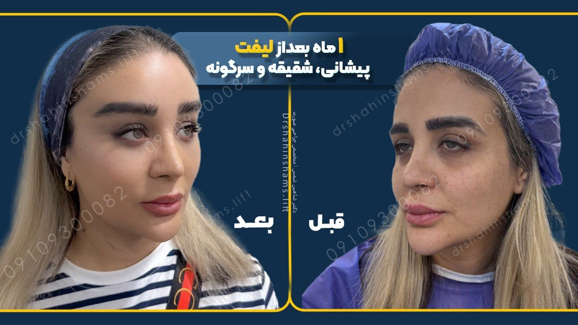 دکتر شاهین شمس | متخصص جراحی زیبایی صورت و لیفت
